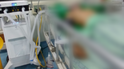 Korban Tabrak Lari di Gowa Masih Koma, Pelaku Belum Diketahui