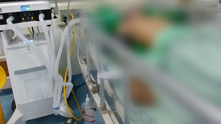 Korban Tabrak Lari di Gowa Masih Koma, Pelaku Belum Diketahui 1 Korban Tabrak Lari di Gowa Masih Koma, Pelaku Belum Diketahui